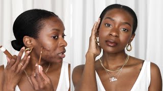 How To Cover Acne amp Acne Scars With NO FOUNDATION  Minimal Makeup Routine [upl. by Ellehcrad720]