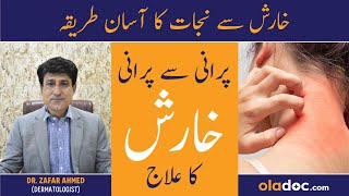 Kharish Khatam Karne Ka Tarika  Scabies Ka Ilaj In Urdu  Itching Treatment  Kharish Ka Fori Ilaj [upl. by Einnok]