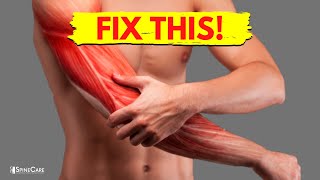 How to Fix Arm Muscle Pain in 30 SECONDS [upl. by Chandos]