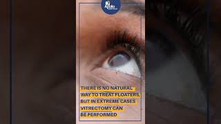 How to reduce floaters in the eyes  Apollo Hospitals [upl. by Ikkir]