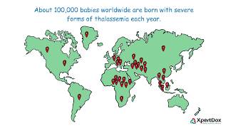 What is Thalassemia [upl. by Ameerak]