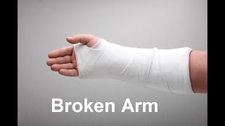 Broken Arm Fractured Arm Symptoms and Causes  Diagnosis  Treatment  Prevention healthcare [upl. by Hazmah885]