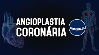 ANGIOPLASTIA CORONÁRIA  SÉRIE SAÚDE BRASIL [upl. by Siroved915]