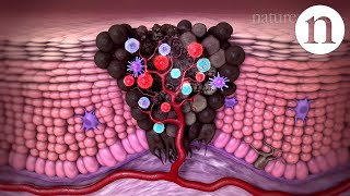 Tumour immunology and immunotherapy [upl. by Srednas]