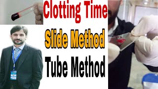 Blood clotting time determination by slide and tube method  CT Test [upl. by Tippets289]