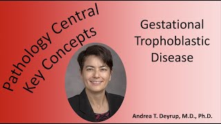 Gestational Trophoblastic Disease Molar Pregnancy Explained [upl. by Nadine985]