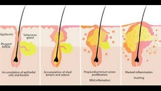 The sebaceous gland [upl. by Anieral]