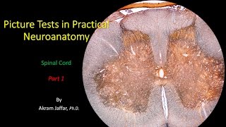 Picture Test in Neuroanatomy  Spinal Cord 1 [upl. by Elianora126]