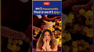 क्या है Pneumonitis जिससे हो सकती है मृत्यु riteshjaiswalsir science shorts viral sanskritiias [upl. by Asia]