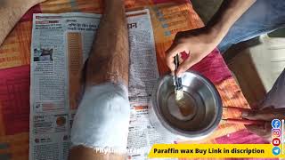 what is a paraffin bath physical therapy paraffin wax Treatment at home physiotherapy wax benefits [upl. by Wichern]