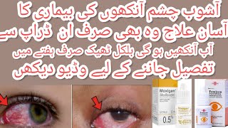 Moxigan amp femicon eye drops uses in urdu l best for eyes infection and itching by aneespharmacist [upl. by Nuawd708]