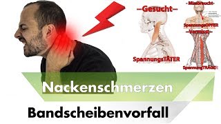 NACKENSCHMERZEN amp HWS Bandscheibenvorfall  Symptome Ursachen amp Lösungen [upl. by Viguerie]