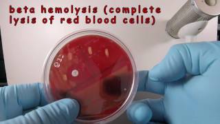 Streptococcus pyogenes on Blood Agar with a Taxo A Disc [upl. by Kcirdes]