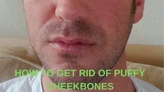 how to get rid of puffiness on cheekbones [upl. by Courtund]