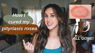 How I Cured My Pityriasis Rosea [upl. by Uria]