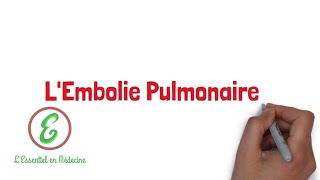 LEssentiel sur lEmbolie Pulmonaire [upl. by Eineg976]