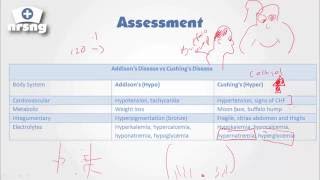 Cushings Syndrome NCLEX® Review  NRSNGacademycom [upl. by Gertrude488]