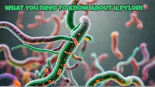 Helicobacter pylori Exposed What You Need to Know [upl. by Ydneh]