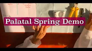 Palatal Spring Demo [upl. by Gladdy325]