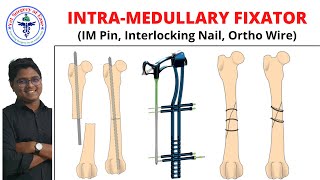 Intramedullary Fixation  Lecture 08  Orthopedics [upl. by Goetz]