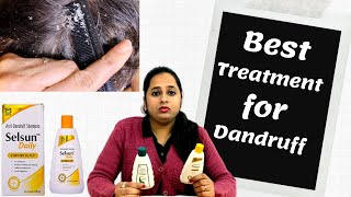 Best Treatment For Dandruff  Selsun Daily Care Shampoo  Anti Dandruff Treatment [upl. by Nnylrefinnej312]