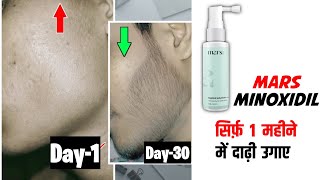 1 month results of minoxidil mars by ghc  mars minoxidil review  minoxidil beard growth beard oil [upl. by Libbey]