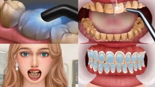 ASMR Mouth Cleaning  Get rid of bad breath  tonsil stones removal salivary glands cleaning [upl. by Marra343]