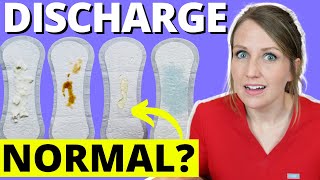 Doctor Answers Top 5 Discharge Questions [upl. by Nitsej457]