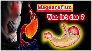 Was ist Magenreflux In 5 Minuten verstehen [upl. by Riha240]