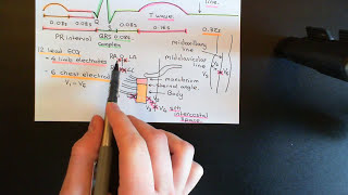 The Electrocardiogram ECG Part 3 [upl. by Heller422]