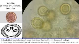 34 Practical Parasitology  Eggs of T Solium and T Saginata [upl. by Portwine]