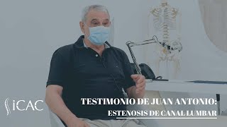 Operación de estenosis de canal lumbar en L4L5 [upl. by Amehsat]