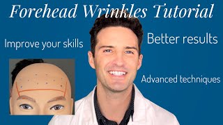 Forehead Wrinkles Treatment Tutorial beginner and advanced [upl. by Eliathas432]