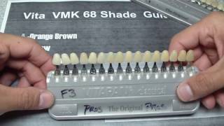 Vita Shade Guide Explanation [upl. by Brittani]