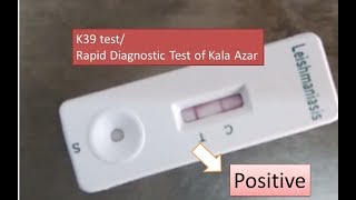 K39 test poaitive  Kala Azar Leishmaniasis  Visceral Leishmaniasis RDT k39 test Rapid test [upl. by Meda]