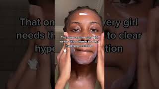 How to fade hyperpigmentation FAST [upl. by Roti]