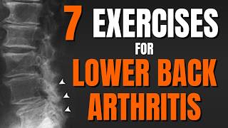 Top 7 Exercises to Ease Spondylosis amp Back Arthritis Pain Ages 60 [upl. by Sebbie]