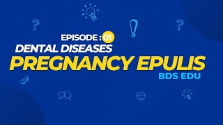 Pregnancy Epulis  Dental Diseases  Episode  01 BDS Edu [upl. by Antonia]