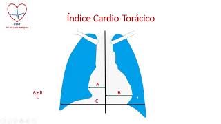 Como medir el índice cardiotorácico ICT en la radiografía PA de tórax [upl. by Enitsirhk]