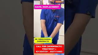 CHIROPRACTIC TREATMENT IN INDIA  NAVEL DISPLACEMENT  DR VARUN DUGGAL CHIROPRACTIC shortfeed [upl. by Ecirum]