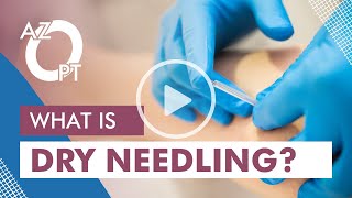 What is Dry Needling [upl. by Anrak]