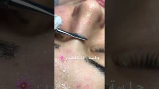 تقشير البشرة بأحدث الطرق 2020❤️skin care 2020 [upl. by Eiznekcm]