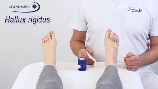 Verbandanlage nach minimalinvasiver Hallux rigidusOperation [upl. by Hajidak]