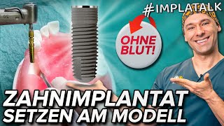 Implantat setzen am Modell  Komplette Implantat OP ohne Blut  Doc Helka erklärt alle Schritte [upl. by Evin66]