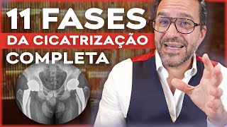 QUANTO TEMPO leva pra CICATRIZAÇÃO completa da CIRURGIA de prótese de quadril [upl. by Chura301]