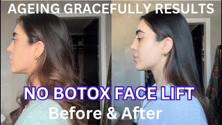 RESULTS  30 Days facial massage before and after [upl. by Yroj771]