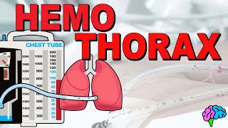 What is a Hemothorax EXPLAINED [upl. by Damour]