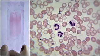 Blood Smear Preparation and Staining Practical Lab [upl. by Rehpotsrhc818]