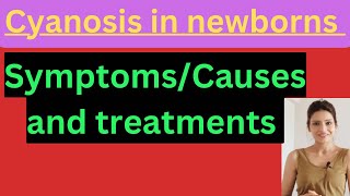 Cyanosis in babies causes symptoms and treatments [upl. by Ian]