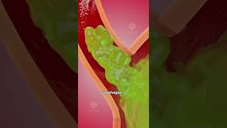 How acid reflux happens 🥵 Acidity and gas problem  GERD shorts viralvideo  creativelearning3d [upl. by Elgar]